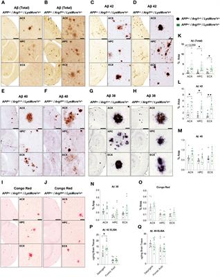 Arginase 1 Insufficiency Precipitates Amyloid-β Deposition and Hastens Behavioral Impairment in a Mouse Model of Amyloidosis